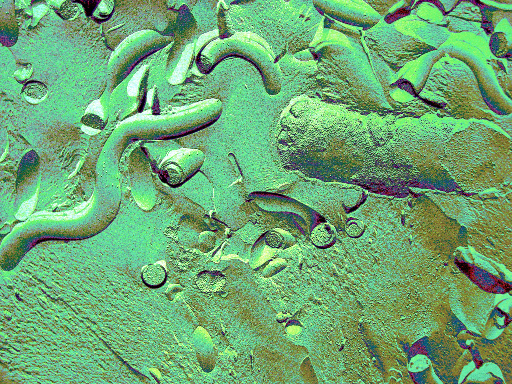 TEM FREEZE FRACTURE OF TREPONEMA AND E. COLI