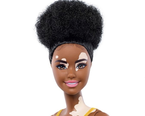 Barbie New Additions Vitiligo, Disabilities
