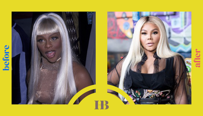 Lil Kim's Before and After "Plastic Surgery"