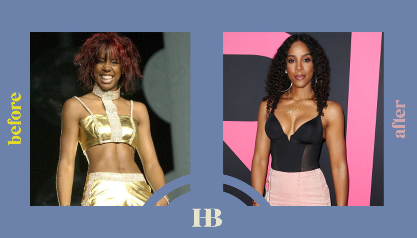 Kelly Rowland's Before and After "Plastic Surgery"