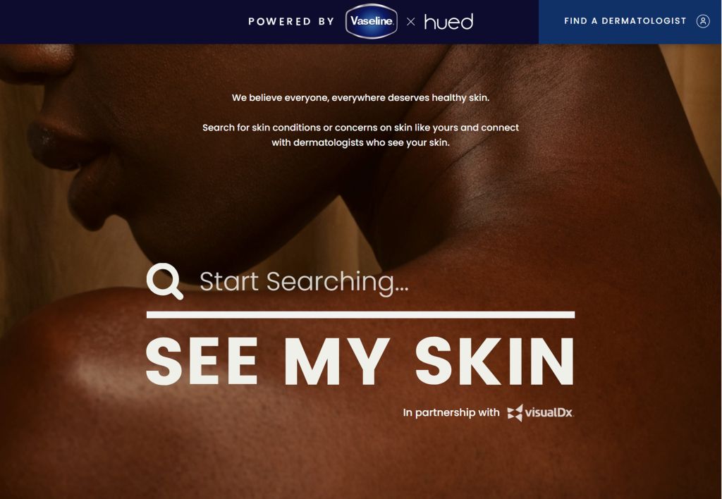 See My Skin website shot