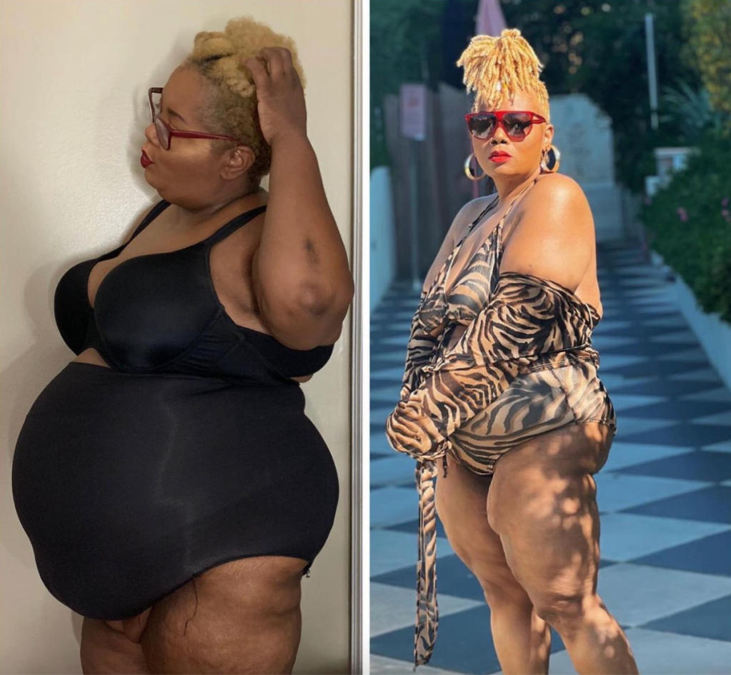 Maui BIgelow weight loss before and after